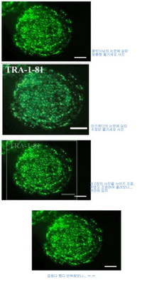 미즈메디병원의 수정란 줄기세포 1번(Miz-hES1의 TRA-1-81)을 좌우로 약간 압축할 경우 황 교수팀의 배아줄기세포 5번(NT-hESC-5의 TRA-1-60) 사진과 동일하다는 것을 알 수 있다. 출처 : 디시인사이드.