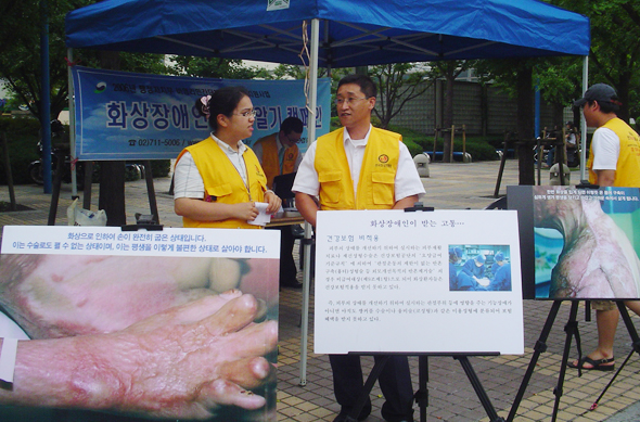 (사)한국화상장애인협회는 이달 내내 수도권 등지를 돌며 화상환자 사진전과 실태를 알리는 ‘화상인 바로알기 캠페인’을 진행하고 있다. 김미영 기자