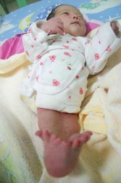 중국 후난(湖南)성에서 ‘인어아기’ 가 태어났다고 중국 동포신문인 길림신문이 20일 인터넷 판으로 보도했다.(서울=연합뉴스) 중국 후난(湖南)성에서 ‘인어아기’ 가 태어났다고 중국 동포신문인 길림신문이 20일 인터넷 판으로 보도했다.(서울=연합뉴스)