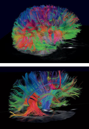 살아 있는 사람 뇌 속에서 신경섬유 가닥들이 얽히고설켜 뇌의 국소영역 1천곳이 어떻게 서로 연결돼 있는지 보여주는 뇌영상. 다른 뇌 기능을 하는 신호들을 구분하고자 다른 색깔들이 쓰였다. 사람마다 활발한 특정 신호의 연결망이 다르기 때문에 뇌영상도 사람마다 다르게 나타난다. 영상 <테크놀러지 리뷰>