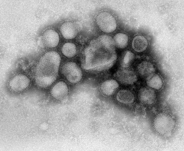 신종 인플루엔자A (H1N1) /과학향기