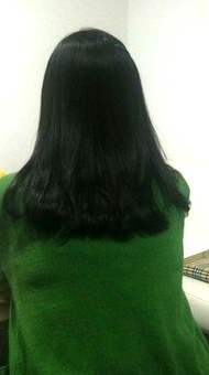 박아무개씨는  ‘눈 미백 수술’을 받은 후 살 자람 증상이 발생하자 네 차례나 제거 수술을 받았다.