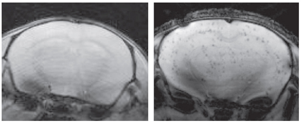 실험 쥐의 뇌에 강자성 산화철 나노입자를 표지로 붙인 세포를 주입한 뒤 엠아르아이(MRI)로 찍은 영상. 세포단위로 영상화할 수 있어 세포치료 뒤 상황을 실시간으로 검사할 수 있다.