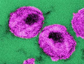 전자현미경으로 본 인간면역결핍바이러스(HIV).