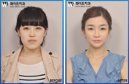 자료제공 : 화이트치과