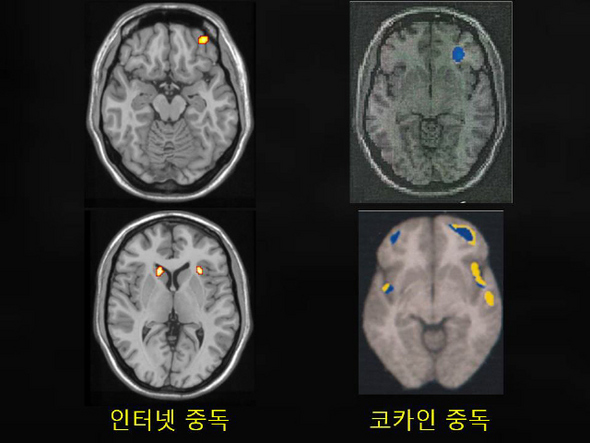 인터넷게임 중독자의 뇌는 마약 중독자와 비슷하다. 한겨레 자료사진