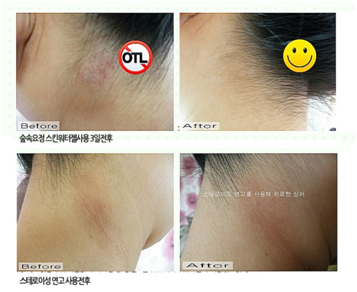 자료 제공 : 라홍