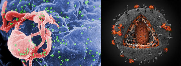 HIV에 감염된 숙주 세포의 전자현미경 사진(왼쪽)와 HIV의 3차원 일러스트(오른쪽, 내부 구조가 보이도록 그렸다). 출처/ wikipedia, http://visualscience.ru