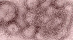 ‘H3N2v‘로 명명된 변종독감 바이러스. 출처/ CDC