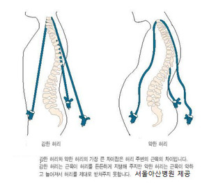 척추 근육의 힘을 충분히 키워야 척추뼈 골절은 물론 디스크 질환에 걸릴 가능성을 낮출 수 있다. 서울아산병원 제공