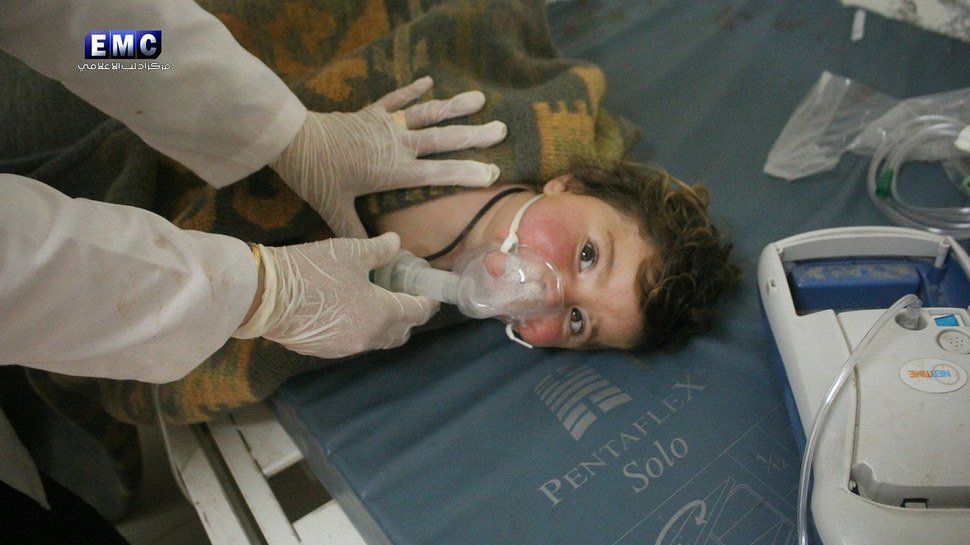 4일 화학무기 공격을 받은 것으로 알려진 시리아 북서부 이들리브주의 칸샤이쿤에서 어린이가 호흡기 치료를 받고 있다. 입에 거품을 무는 것은 화학무기 피해의 전형적 증상이다. 이들리브/EPA 연합뉴스