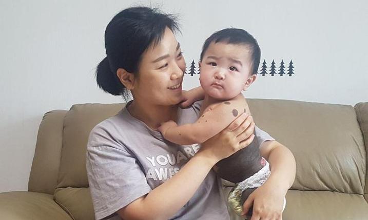 희귀질환 아이 엄마의 다짐…저는 강한 엄마가 될 거예요