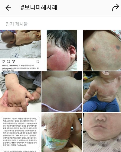 인스타그램에서 ‘보니 피해사례’로 검색하면 보여지는 사진들이다. 보니코리아 아웃라스트 에어매트를 사용한 뒤 피부 발진이 일어났거나 기침 증상이 나타났다고 하소연하는 피해자들이 많다. 인스타그램 갈무리 사진.