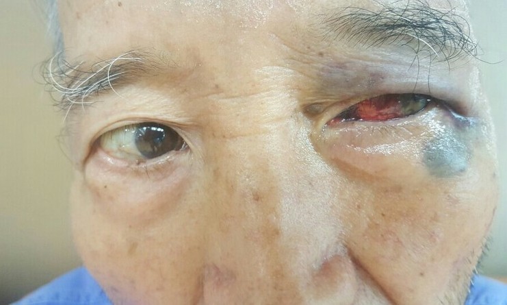 광주서 “병원 의사가 치매 환자 폭행” 의혹 제기