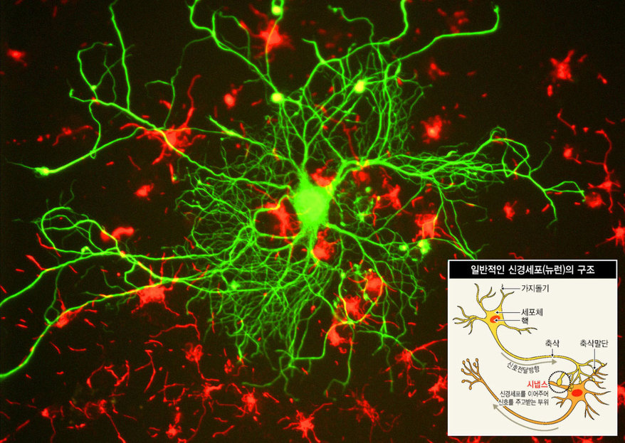 신경세포(뉴런)의 현미경 사진. 뉴런들 사이에서 기억과 인지의 뇌 기능에 중요하게 관여하는 단백질이 실은 바이러스 껍질 구조를 하고서 바이러스처럼 거동하는 것으로 밝혀졌다. 이 단백질은 오래전 바이러스가 남긴 유전자 흔적일 것으로 추정된다. 위키미디어 코먼스 제공