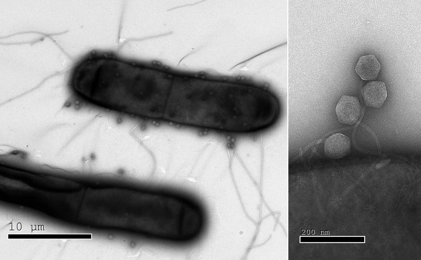 박테리아는 단세포 생물이지만 바이러스의 공격에 맞서 다양한 면역방어 시스템을 갖추고 있다. 최근 이스라엘 연구진이 이전까지 몰랐던 박테리아의 여러 면역방어 시스템을 새로 발견했다. 왼쪽의 전자현미경 영상은 대장균 껍질에 달라붙은 많은 바이러스들(작은 공 모양)을 보여준다. 오른쪽은 바이러스를 중심으로 확대한 영상. 이스라엘 바이츠만과학연구소 제공