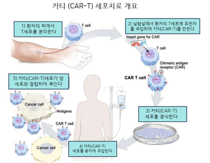 그림 5. 카티(CAR-T) 세포 치료의 개요. 환자의 피로부터 분리한 T세포에 암세포를 인식하고, T세포의 면역 활성 신호를 주도록 설계된 유전자 (CAR, Chimeric antigen receptor)를 주입한다. 이렇게 완성된 카티(CAR-T)세포들을 수백만개로 증식시킨다. 이 과정에 2주이상의 시간이 소요된다. 준비된 카티세포를 환자에 주입하면, 카티세포들은 암세포와 결합하여 암세포를 죽인다. 그러나, 환자의 피로부터 분리, 증식까지의 시간을 단축하고, 비용도 단축하기 위한 기성품 카티(OTS CAR-T)도 활발히 연구 중이다. 출처: National Cancer Institute.