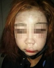페이스북에 올라온 피해자 사진 갈무리.