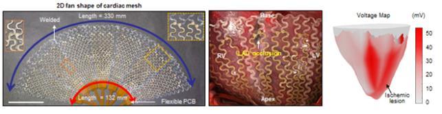 연구팀은 여러 층으로 구성된 그물 형태(메시)로 금-은나노복합체를 설계해 실험 동물인 돼지의 심장에 감아 심장 전체의 신호를 읽는 데 성공했다. 다채널 전극층을 갖고 있어 어느 부위에 병변이 있는지도 확인할 수 있다. 원하는 곳에 전기 자극을 가해 심장 기능의 회복에 도움을 줄 수도 있다. 기초과학연구원 제공