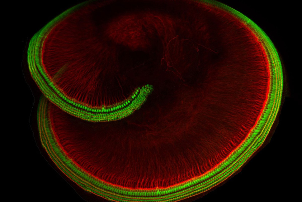 유모세포들이 있는 속귀의 달팽이관. 미국 하버드의대 제공