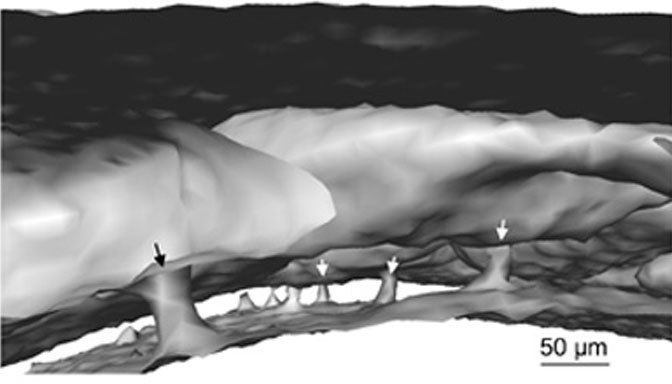 머리뼈 골수에서 생성된 면역세포들이 머리뼈에서 뇌막으로 이동하는 경로인 미세 통로들(화살표)의 마이크로단층촬영 영상. 미국 하버드대학 의대 제공