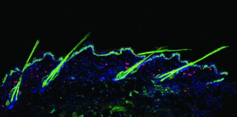 쥐 피부의 확대면. 조절T세포들(빨간색)이 모낭과 머리카락(녹색) 주위로 모여 보인다. 출처: Rosenblum lab/UCSF