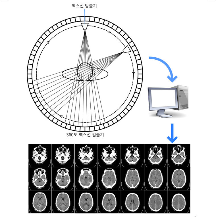 전산 단층 촬영(CT scan: Computed Tomography): 엑스선 검출기는 360도로 둘러서 설치되어 있고, 엑스선 방출기는 돌아가면서 중간에 있는 사람을 향해 엑스선을 비춘다. 엑스선 방출기가 엑스선을 어디에서 비춰도 반대편에서 엑스선 검출기로 엑스선을 검출할 수 있는 구조다. 여러 방향에서 검출한 엑스선 데이터로부터 컴퓨터는 인체 내부의 단면(가로지르는 면) 사진을 합성한다. 연속된 여러 단면 사진을 겹치면 인체 내부의 3차원 사진이 만들어진다.. 컴퓨터 그림 출처: openclipart.org, CT 사진 출처: wikimedia commons