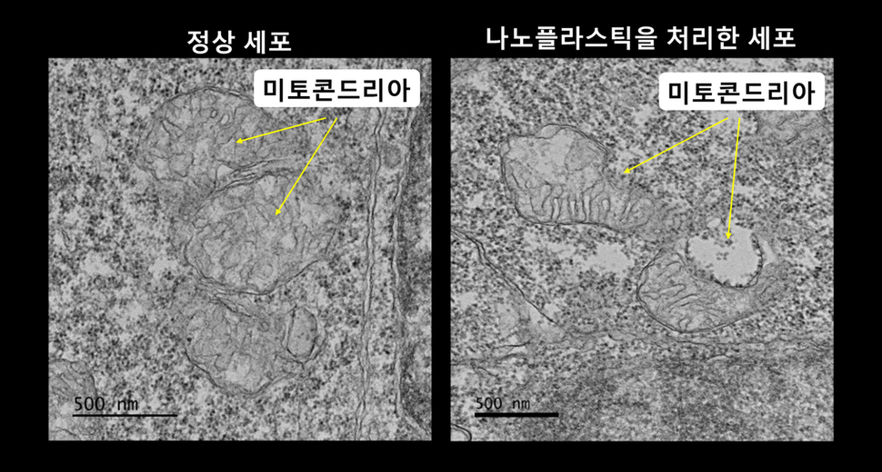 나노플라스틱에 노출된 물고기 배아의 세포 속에 있는 미토콘드리아는 정상 배아세포와 비교한 전자현미경 사진. 정상 세포의 미토콘드리아(왼쪽)는 본래의 모양을 잘 유지하는 반면 나노플라스틱을 처리한 세포의 미토콘드리아는 모양이 일부 망가져 있다. 한국생명공학연구원 제공