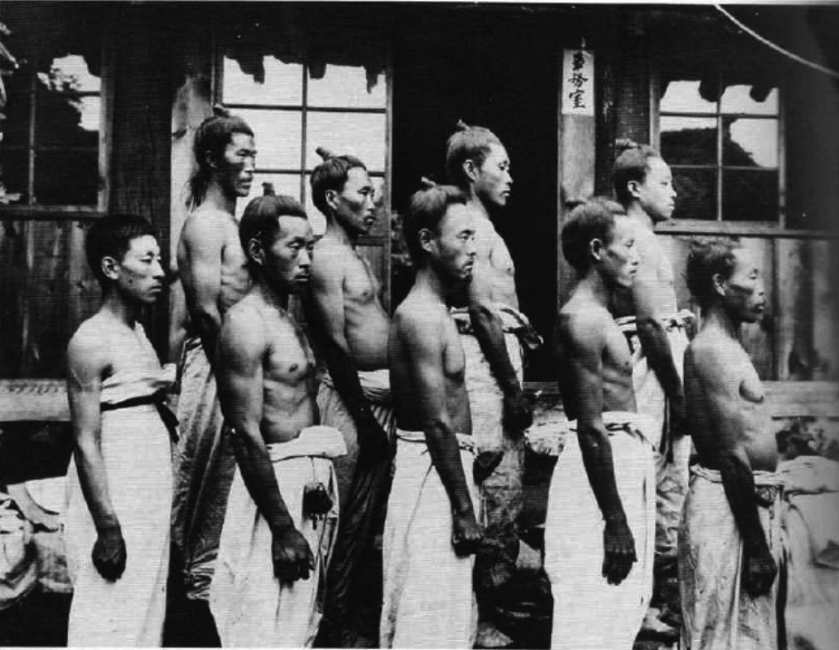 일본의 식민지 통치 시절 조선인 인체를 측정한 사진. 함경남도 덕원 남자 측면 체격 측정. 1911년.