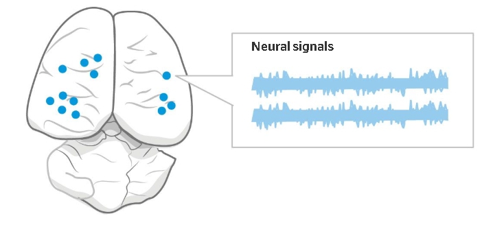 뉴럴링크는 쥐의 뇌에 삽입된 전극을 통해 뇌 외부에서 소프트웨어를 통해 뇌의 신호를 분석했다.   출처 뉴럴링크(Neuralink; “The ‘Sewing Machine’ for Minimally Invasive Neural Recording”, Hanson et al.)