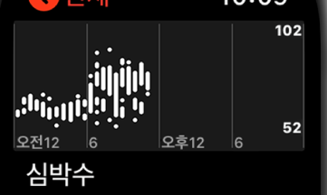 “스마트워치, 심박체크 건강 역효과” 