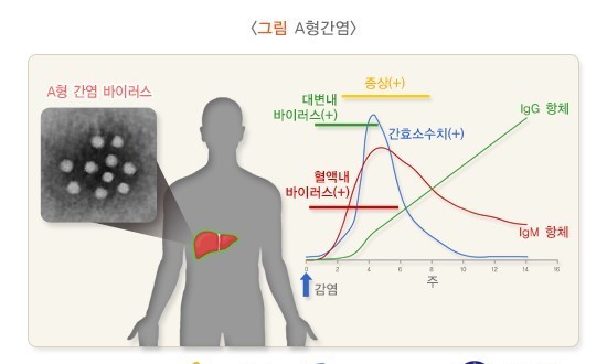 부산 식당서 손님 71명 A형 간염 집단 발병