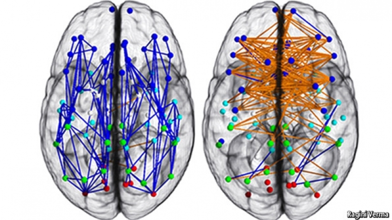 남녀의 뇌를 비교하는 많은 연구 중 하나(2013). 남자(왼쪽)와 여자의 뇌 연결망 구조 차이를 보여주는 그림. 미국 펜실베이니아대학 의대 연구팀 제공