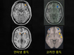 “게임 중독자의 뇌, 마약 중독자와 비슷”