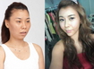 25세 화성인 노안녀, 미니양악 등 성형 수술로 달라진 모습 '화제'