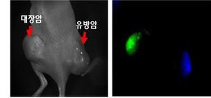 한번 주사로 하루만에 ‘2가지 암’ 동시 진단