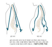 등 근육이 튼튼해야 척추가 쫙 