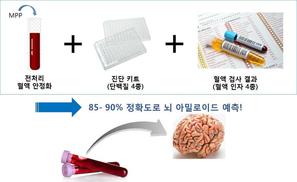 혈액 검사로 알츠하이머병 예측한다