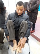 주물공장에서 40여년…납중독에 손발톱이 빠졌다