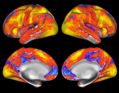 뇌 기능을 보여주는 뇌 영상의 예.  미 국립보건원 제공
