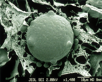 일반적인 항아리곰팡이의 현미경 영상. 위키미디어 코먼스 제공