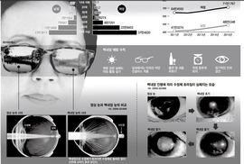 “시야 흐려지니 실명 공포…노화 탓이라니 슬프네요”